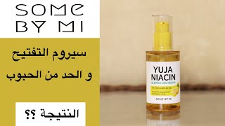 Some by mi Yuja Niacin serum تجربة سيروم يوجا نياسين من سوم باي مي [upl. by Glynn]