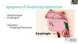 Managing Gastrointestinal GI Impacts of DM [upl. by Ringo]