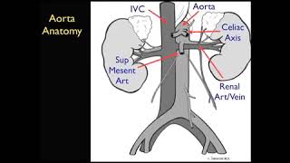 Aorta Ultrasound  Introduction  SonoSite Inc [upl. by Ellerd]