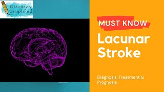 Must Know Lacunar Stroke [upl. by Anivlac]