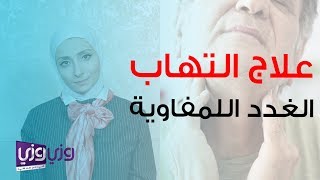 علاج التهاب الغدد اللمفاوية [upl. by Meelas]