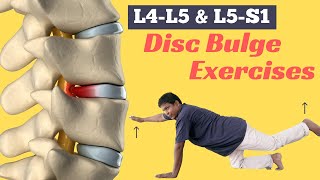 6 Best Diffuse Disc Bulge at L4L5 and L5S1 Treatment Exercises [upl. by Germain]