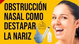 Para La OBSTRUCCION NASAL Te Digo Como Destapar La Nariz Con El Lavado Nasal Con Suero Fisiologico [upl. by Syverson824]