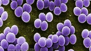 Staphylococcus aureus [upl. by Lapotin]