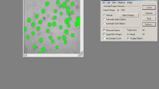 Threshold amp Measure Objects  ImagePro Plus Software [upl. by Cooperstein]