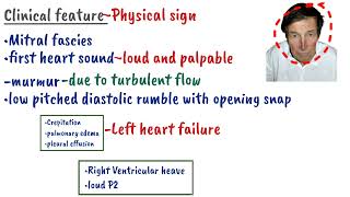 Mitral Stenosis  Valvular heart diseaseCardiology medicine [upl. by Arrait]