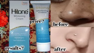 hitone whitening cream  best medicated cream for skin brightening amp freckles  pigmentation [upl. by Rastus459]