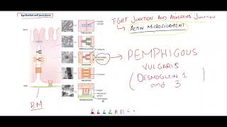 Pemphigus vulgaris vs Bullous pemphigoidEpithelial cell junctions [upl. by Carr]