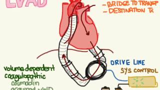 LVAD 01 Anatomy and Physiology [upl. by Frayda]