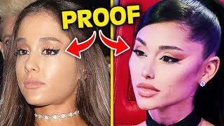 Top 10 Influencers Who DESTROYED Their Face With Plastic Surgery [upl. by Wilkison]