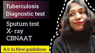 Tuberculosis Diagnosis  CBNAAT  Sputum test  X ray  tuberculosis diagnosis cbnaat [upl. by Imre]