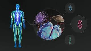 TREMFYA® guselkumab Mechanism of Action for Plaque Psoriasis [upl. by Garcon984]