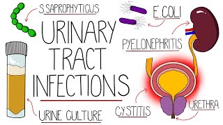 UTI Made Easy  Urinary Tract Infections Explained Clearly [upl. by Akaya406]