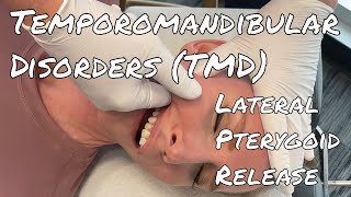 TMDTMJ Pain  MSR Lateral Pterygoid Release [upl. by Aehtna]