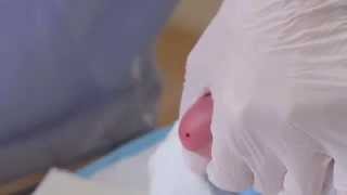 CLSI Newborn Screening DVD  Informational Video Trailer [upl. by Akemot]