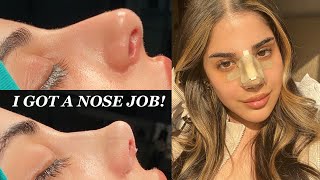 I GOT A NOSE JOB IN TURKEY WITH THE BEST SURGEON  PART 1  CLINICHUB [upl. by Enirhtac867]