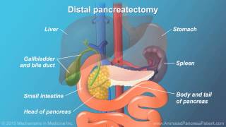 Pancreatic Surgery Benefits Risks and Relevant Anatomy [upl. by Charmain340]