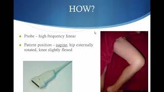 POCUS for Lower Extremity DVT [upl. by Nahsar]