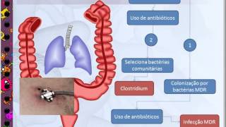 Epidemiologia das infecções e Antibioticoterapia em UTI [upl. by Noinatrad555]