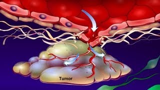 Introduction to Cancer Biology Part 4 Angiogenesis [upl. by Ettenirt]