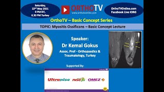 Myositis Ossificans A Basic Concept Lecture  Kemal Gokus [upl. by Andee362]