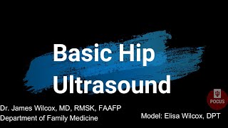 Basic Hip Ultrasound [upl. by Zehe]