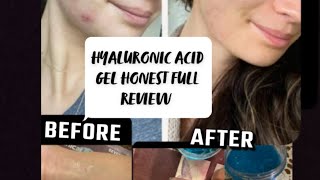 UpTown la hyaluronic acid gel review ll best moisturizer ll uses of hyaluronic acid [upl. by Yemar863]