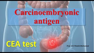 Carcinoembryonic antigen CEA test [upl. by Einnol]