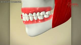 What is Anterior Crossbite [upl. by Aerbma]