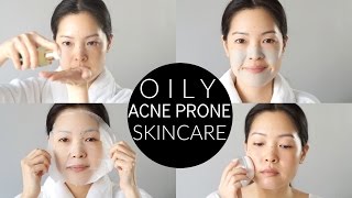 Basic Oily amp AcneProne Skincare Routine and Essentials [upl. by Soma]