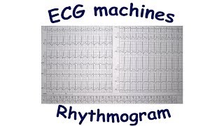 ECG machines rhythmogram [upl. by Nilrak]