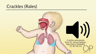 Respiratory Assessment by B Leary L DelSignore  OPENPediatrics [upl. by Howenstein]