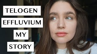 TELOGEN EFFLUVIUM  MY RECOVERY STORY  LAUREN NEWLY [upl. by Feigin]