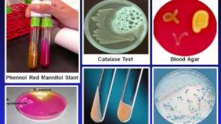 Introduction to Microbiology Culture Techniques [upl. by Lorilyn622]