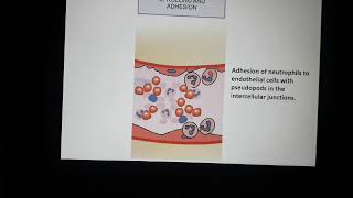 Acute inflammation 4 Cellular events exudation of leucocytes [upl. by Arba915]