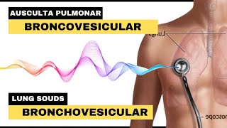 SOM BRONCOVESICULAR AUSCULTA PULMONAR  Bronchovesicular Breath Sounds  Lung Sounds [upl. by Toy]