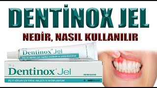 Bebeklerde Diş Çıkarma ve İltihap Durumlarında Dentinox Jel [upl. by Naihr]