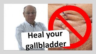 Heal your gallbladder naturally  NOW [upl. by Palladin916]