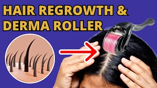 How Does the Derma Roller Help with Hair Regrowth [upl. by Kaleb]