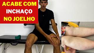 EXERCÍCIOS PARA INCHAÇO NO JOELHO [upl. by Ahsilek948]