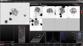 AutoCapt  Automated Image Acquisition with Metafer [upl. by Idarb]