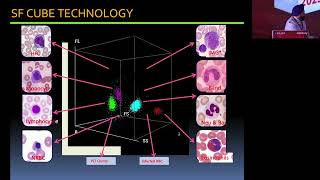 Hemocytomorphometry Explained Analyzing Scattergrams and Histograms  A case based approach [upl. by Ainollopa182]