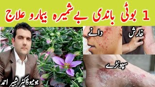 Fagonia Dhamasa Azghaky  ازغکے  دھماسہ  acne pimples ilaj  Pashto New Video  pashtonewvideo [upl. by Euqilegna935]