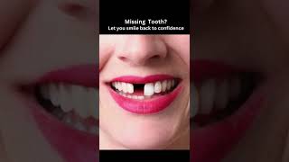 DIY How To Replace Missing Tooth in Less Than 5 Minutes [upl. by Aneeuqal]