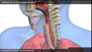 A0001a en A patient´s Guide to Total Laryngectomy Part 1 What is a Laryngectomy [upl. by Ellednahs]