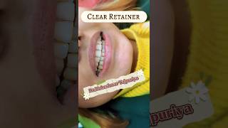 Clear Retainer Retainer after Braces removal Clear Aligner Dental Braces  Dentist in Kathmandu [upl. by Franciscka589]