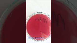 Bacterial culture  Bacterial growth on Media  Microbiology  Culture sensitivity test [upl. by Lac]