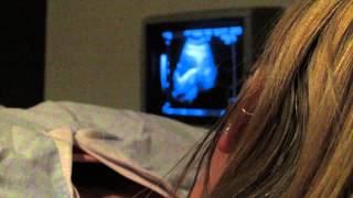 IVF diary  9  IVF the secret cycle  Embryo Transfer IVF [upl. by Ursulette]