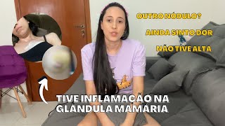 MINHA NODULECTOMIA PELO SUS UM ANO DEPOIS PARTE 2 [upl. by Airdnoed951]