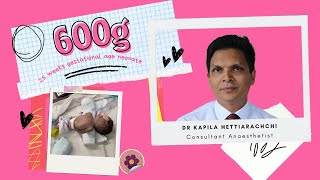 Central Venous Catheter CVC insertion to a 600g neonate by Dr Kapila Hettiarachchi in Sri Lanka [upl. by Labaw]